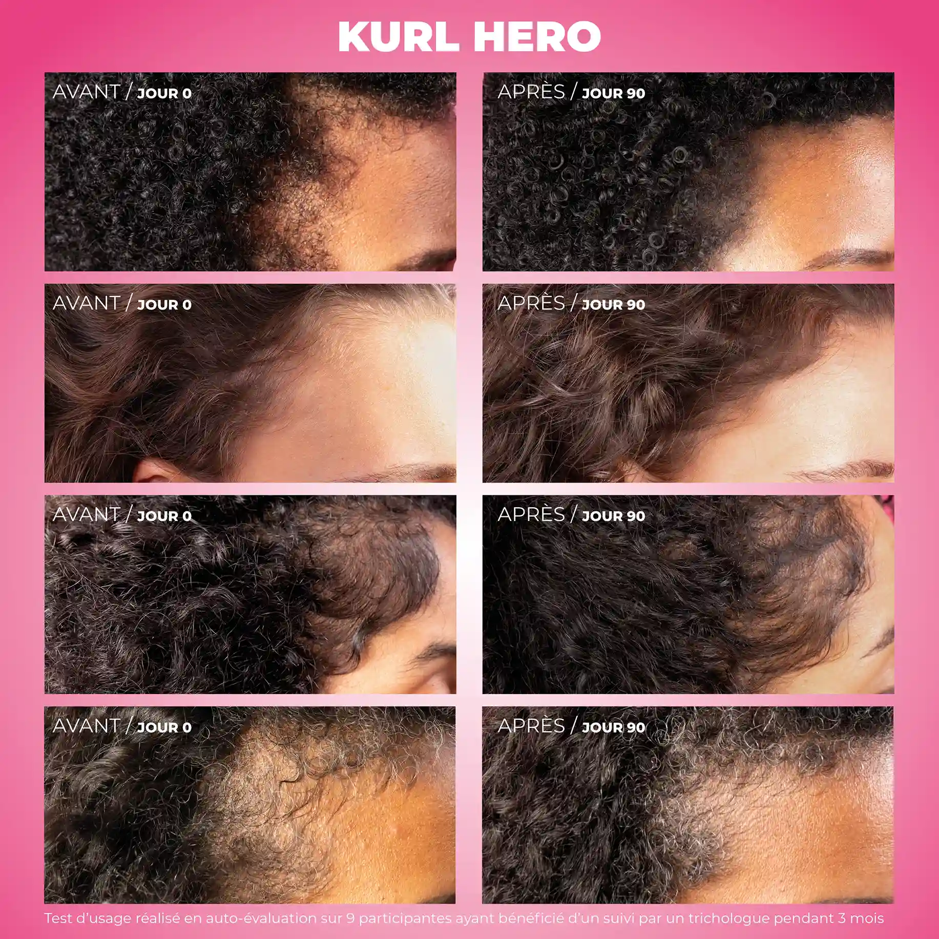 Kurl Hero - Sérum anti-chute, croissance et densifiant - Image 5